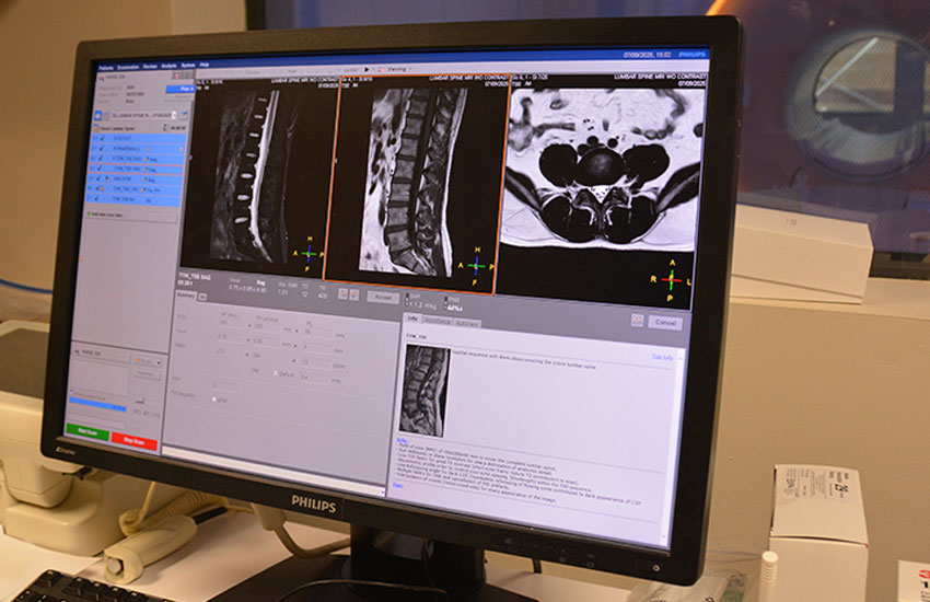 Philips Ingenia MRI System - Advanced Features